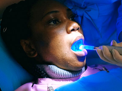 Dentist whitening